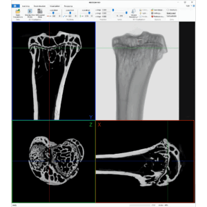Neoscan Software Internal 1